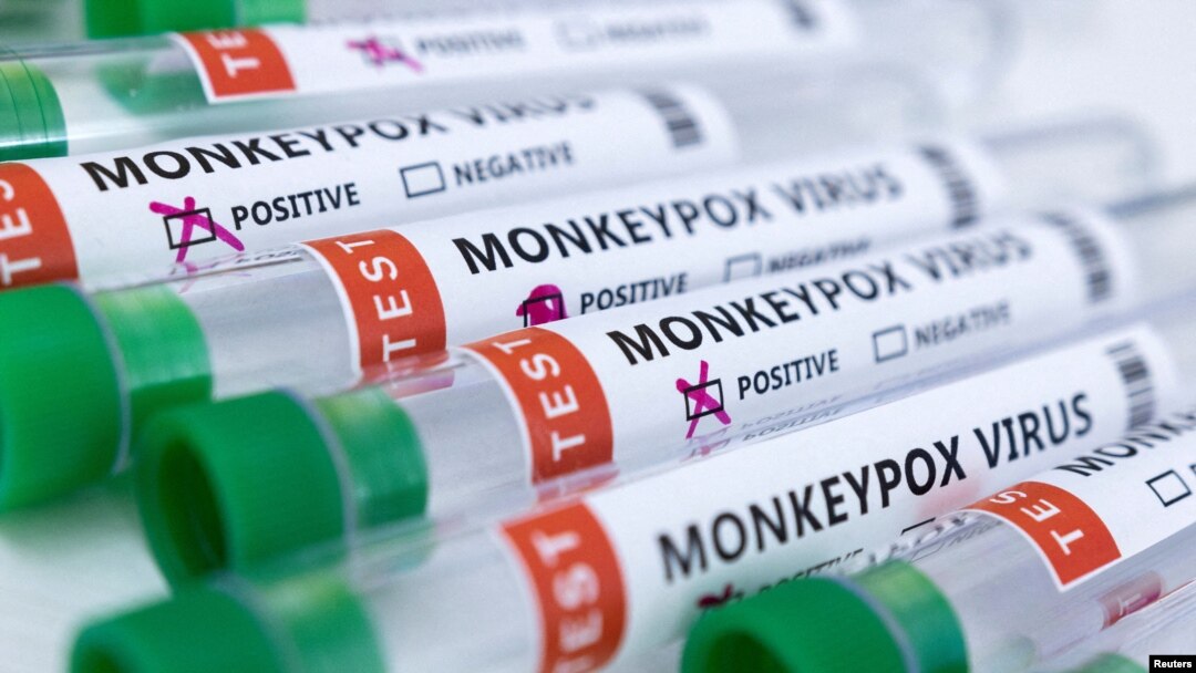 FILE - Test tubes labeled "Monkeypox virus positive and negative" are seen in this illustration created May 23, 2022.