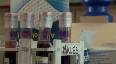 AIDS Vaccine Trial Underway in South Africa