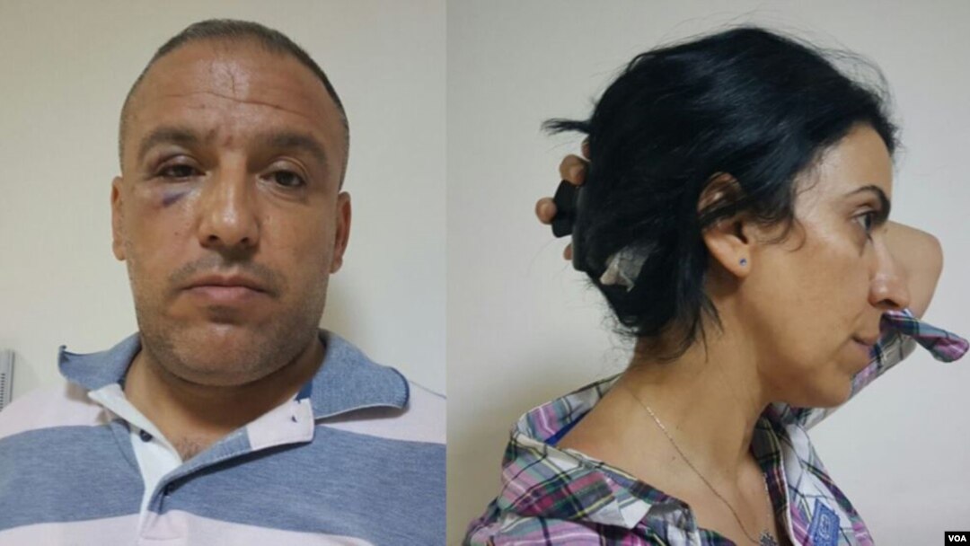 VOA Turkish's Mahmut Bozarslan (L) and VOA Kurdish's Hatice Kamer (R) reported being attacked in Midyat, Turkey, June 8, 2016.