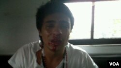 La agresión se produjo cuando Saleh participaba de la Operación Libertad, en Barinas.