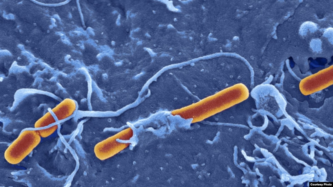 Shigella Sonsei bacterium (photo by David Goulding, Wellcome Trust Sanger Institute)