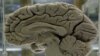 Caffeine and Mental Exercises Improve Memory