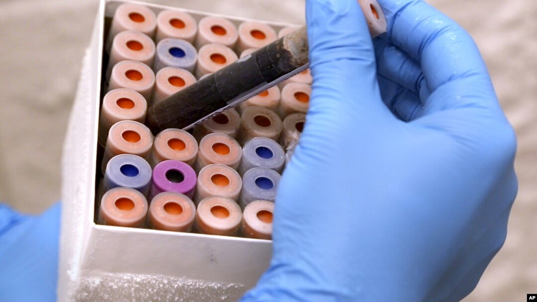 FILE - Lab research analyst does research relating to a new blood test. Researchers have developed a blood test that predicts Alzheimer's disease.