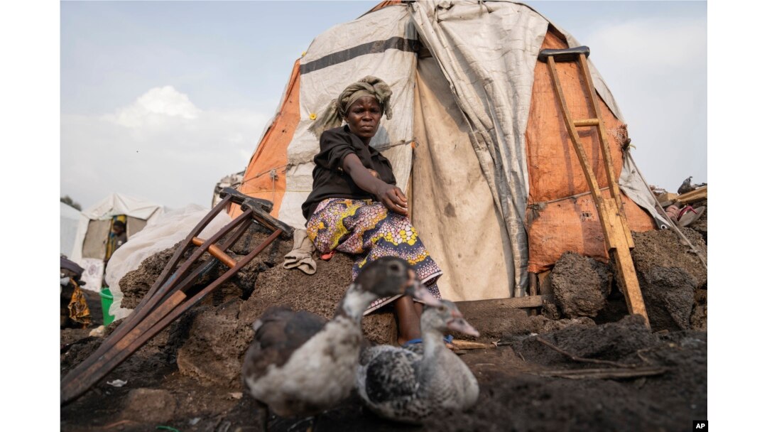 Sarah Bagheni, in the Bulengo refugee camp in Goma, DRC, says she suspects she may be infected with mpox on Aug. 16, 2024, one day after the World Health Organization declared the increasing spread of mpox in Africa a global health emergency.