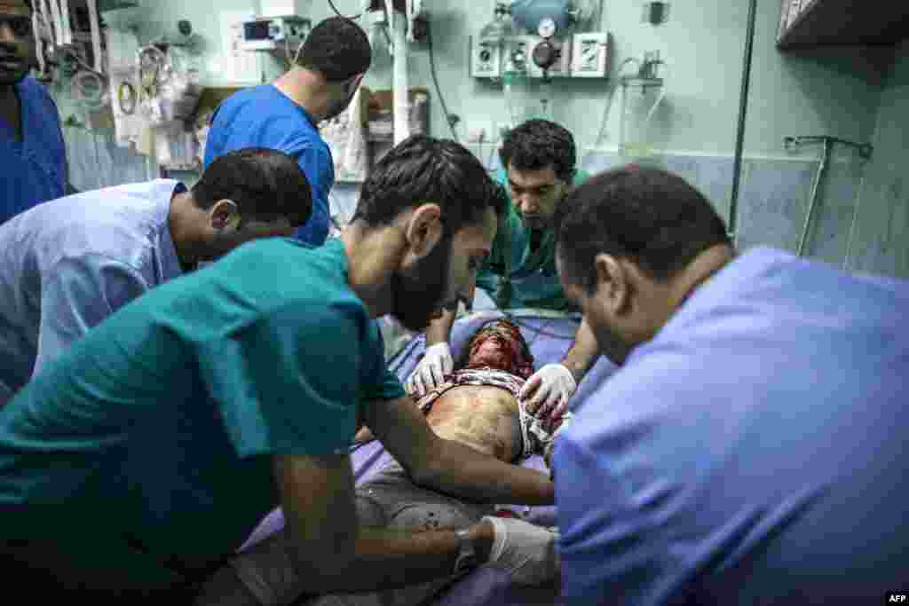 Shahed Qishtah, a nine-year-old Palestinian girl, receives medical care at an emergency room of the Kamal Adwan hospital in Beit Lahia after she was injured in an Israeli strike while playing on July 22, 2014 in the northern Gaza Strip.