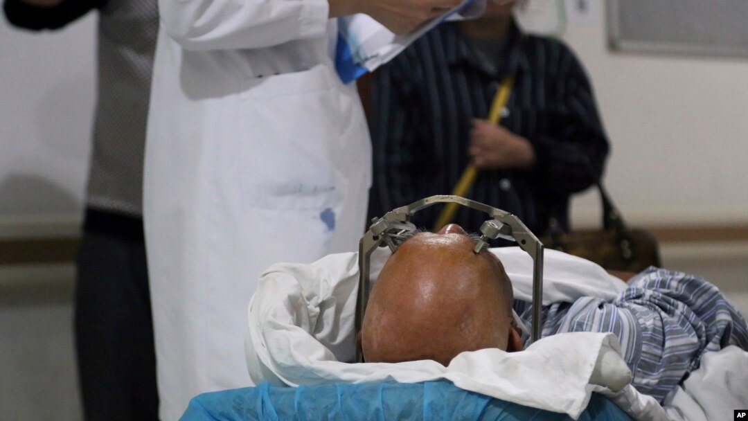 FILE - A stereotactic device presses into the head of a brain surgery patient at Ruijin Hospital's functional neurosurgery center in Shanghai, Oct. 29, 2018. Doctors at Ruijin are experimenting with deep brain stimulation as a treatment for addiction. 