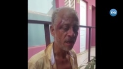 Jornalista António Aly Silva raptado e espancado na Guiné-Bissau