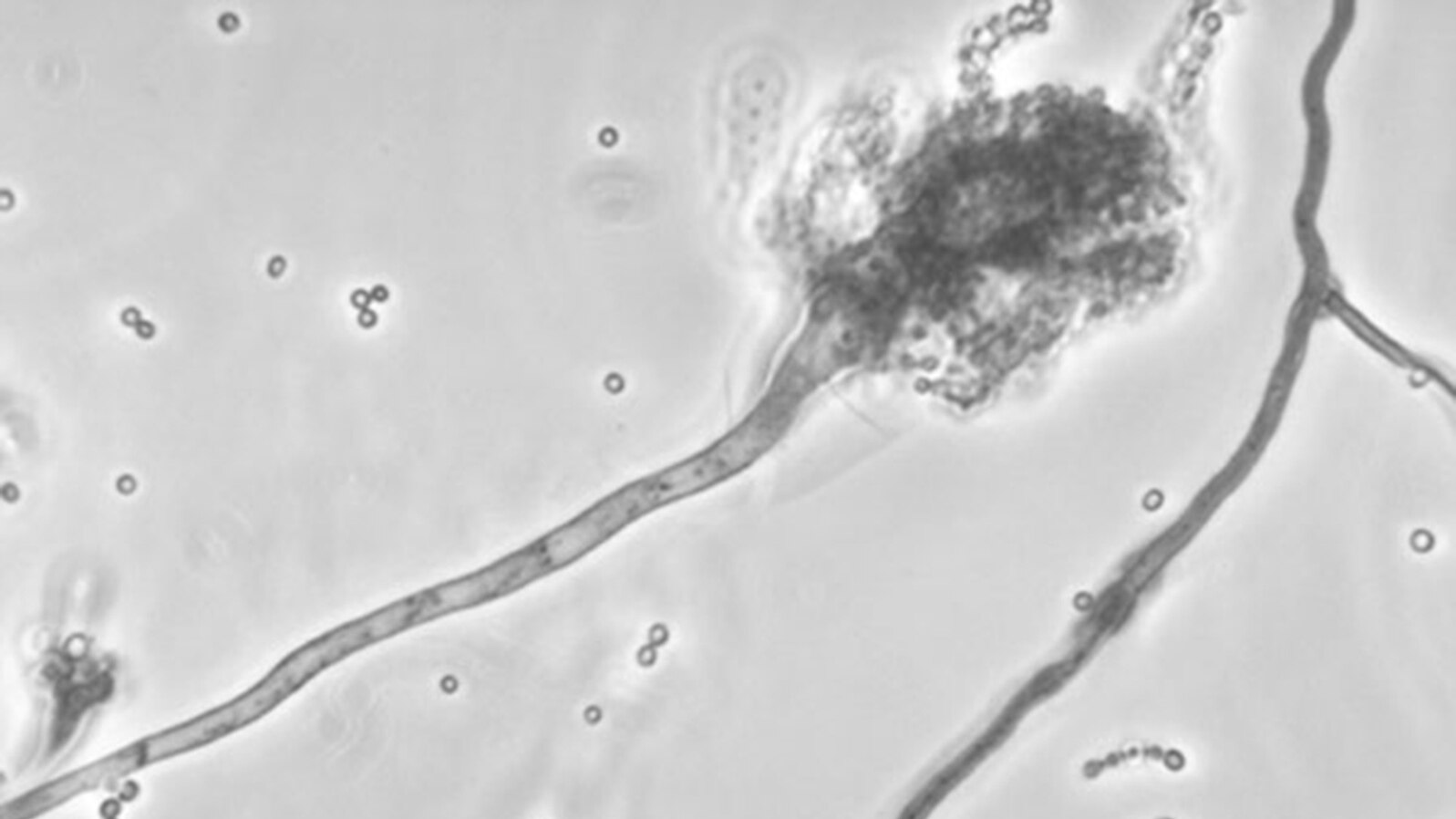 This photo made available by the Centers for Disease Control and Prevention shows a branch of the fungus Aspergillus fumigatus blamed for causing a meningitis outbreak.